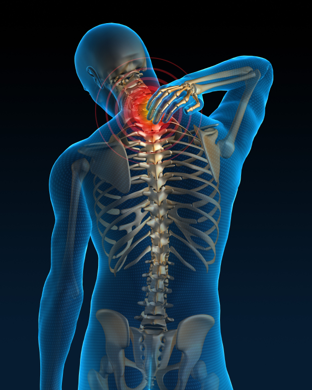 Me duele el cuello – Fisioterapia Majadahonda